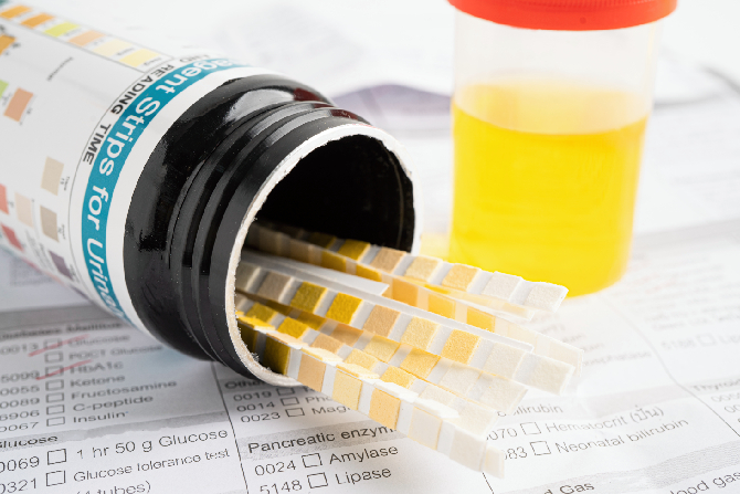 Imágenes de las pruebas antidopings usadas. 