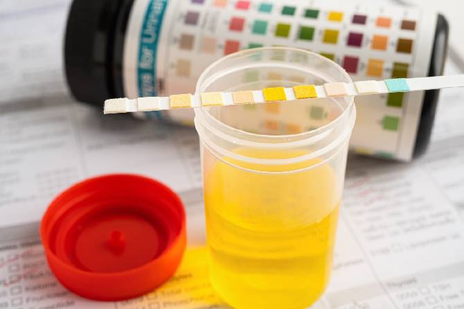 Descubre la clasificación de reactivos en el laboratorio