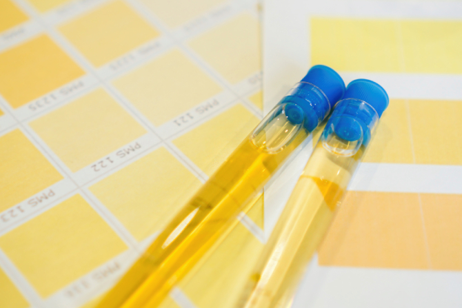 Muestras de orina para detectar droga. 