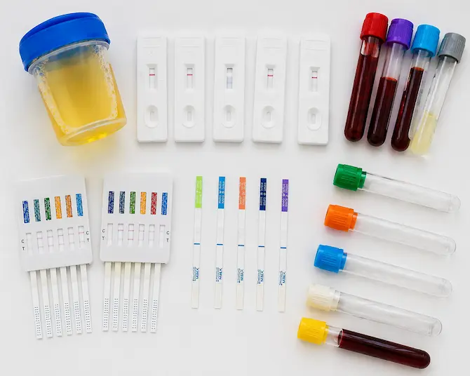 Pruebas toxicológicas tipo cassette y tiras reactivas junto a tubos de muestra de sangre y orina sobre superficie blanca de laboratorio clínico, listos para análisis de diagnóstico