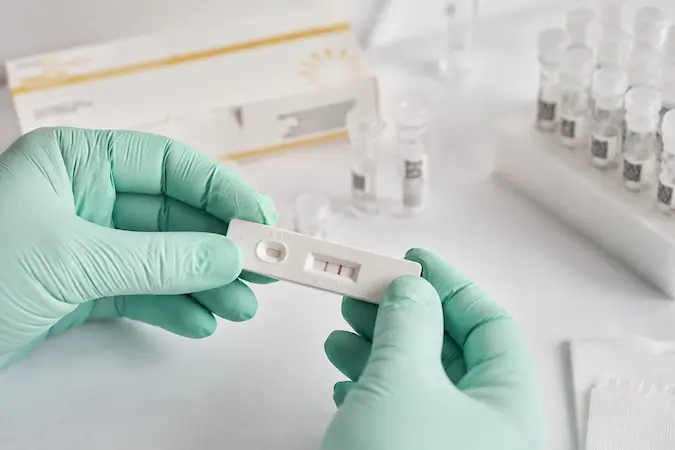 Manos con guantes sosteniendo tira reactiva de diagnóstico SARS-CoV-2 en primer plano sobre superficie clínica