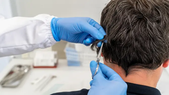Toma de muestra para antidoping capilar: profesional con guantes de nitrilo cortando mechón de cabello en laboratorio clínico