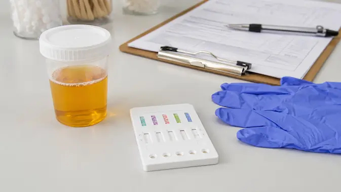 Tipos de prueba de antidoping en orina: vaso recolector junto a cassette multidroga con bandas reactivas visibles y guantes de nitrilo