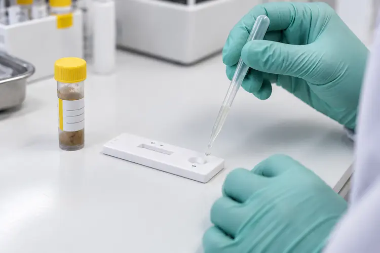 Cómo se diagnostica el rotavirus en un laboratorio clínico