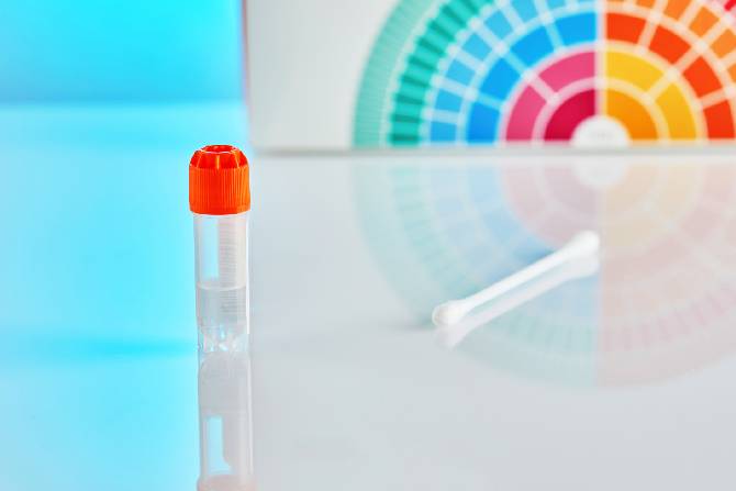 Clasificación de reactivos.