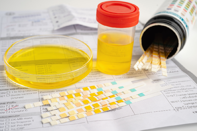 Qué tipo de antidoping hacen las empresas en México