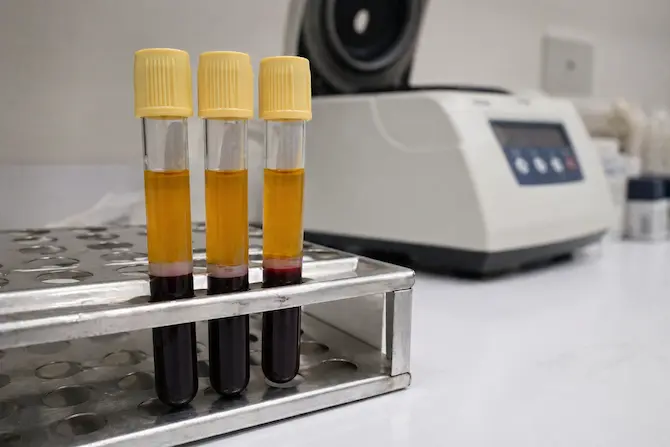 Qué es la serología: tubos de sangre con suero separado tras centrifugación en laboratorio clínico